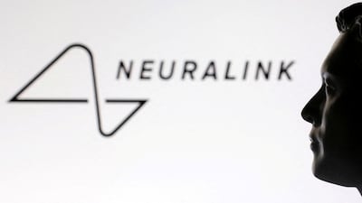 Elon Musk has said Neuralink's research could expand how we experience the world around us. Reuters