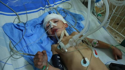 A wounded Syrian child is treated at a makeshift hospital in the rebel-held town of Douma, in the besieged Eastern Ghouta region on the outskirts of the capital Damascus. / AFP PHOTO / HAMZA AL-AJWEH