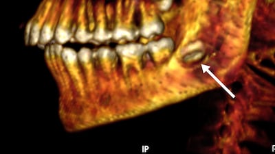 The teenage boy was buried with 49 amulets and items of jewellery in and around his body, suggesting he was from a wealthy family