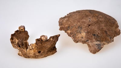 The fossil remains of a skull and a jaw of a new early human species were uncovered at the quarry of a cement plant near the central Israeli city of Ramla. AFP