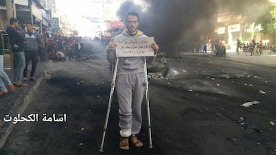 Palestinian journalist Osama Al Kahlout’s photo shows a protestor holding a sign that reads, "I want to live in dignity; I'm wounded and need treatment and a salary," during a protest in Deir al Balah, central Gaza Strip. Osama Al Kahlout via AP