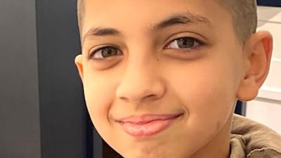 The 3D printed surgical jig developed by Dr Spence for just Dh500 in Dubai allowed a precise incision to cut through Talal’s bone before it was realigned and metal plates fitted. Photo: Farah Sawaf