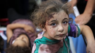 Children who were injured during an Israeli siege on Jabalia refugee camp await treatment at a hospital in Gaza city. AFP