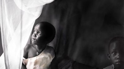 Image from Malaria: Blood, Sweat & Tears photo exhibition at the Emirates Palace (Etihad Ballroom) in Abu Dhabi. Credit. Courtesy of Adam Nadel.