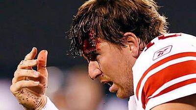 Eli Manning needed 12 stitches in the head wound he suffered against the New York Jets.