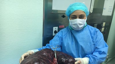 Dr Amal Al Qedrah, head of obstetrics and gynaecology at Latifa Hospital in Dubai, removed a 17.5kg tumour from the abdomen of an Emirati woman. Courtesy Dr Amal Al Qedrah