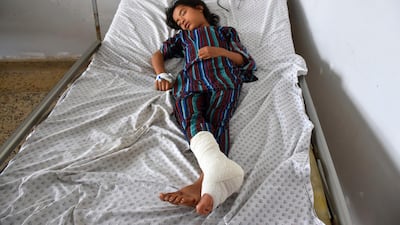 An Afghan girl receives treatment at a hospital after a suicide truck bombing in northern Balkh province of Afghanistan. AP
