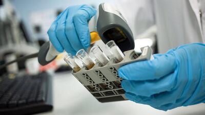 Diabetes is almost entirely preventable. Delores Johnson / The National