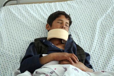 A wounded youth receives treatment at a hospital after gunmen stormed a mosque, killing some worshipers and wounding several others, in Parwan province, north of Kabul, Afghanistan, May 20, 2020. AP Photo
