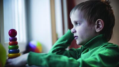 Children with autism tend to experience frequent infections, food allergies and sensitivities. Kurskov Yevgeny/ITAR-TASS Photo/Corbis