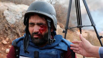 Palestinian cameraman Muath Amarneh reacts after he was hit by a rubber bullet fired by Israeli border police during clashes between Palestinians and Israeli security forces in the village of Surif north-west of the West Bank town of Hebron on November 15, 2019. AFP