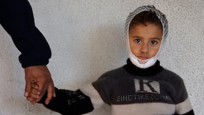 At least 171,000 people in Gaza, including many children, have been injured in more than two years of war. AFP