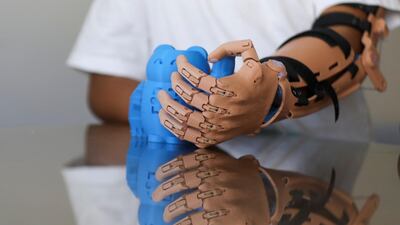 Ayudame3D uses 3D printers to create tailor-made prostheses which it donates to people around the world. Reuters