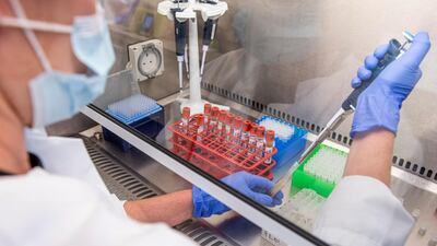 Samples of the University of Oxford coronavirus vaccine trials are handled at a laboratory. AP