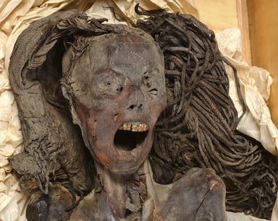 The mummy has been housed at the Egyptian Museum in Cairo's Tahrir Square since 1998. Photo: Frontiers in Medicine