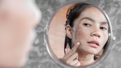 Many woman experience dry skin and pigmentation during pregnancy, while increased sensitivity can make previously used products unsuitable. Getty Images