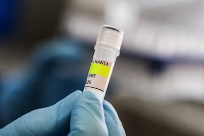 Hantavirus can cause haemorrhagic fever and kidney failure in rare cases. AFP