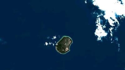 The island nation of Nauru in Micronesia saw a dramatic rise in type-2 diabetes when per capita income skyrocketed. Planet Observer / Universal Images Group via Getty Images