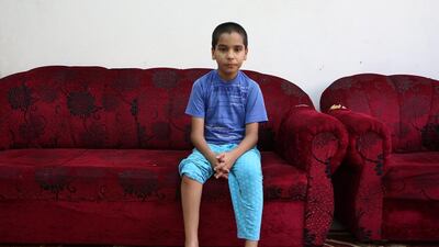 Yousef needs Dh60,000 for surgery on his deformed leg. Pawan Singh / The National