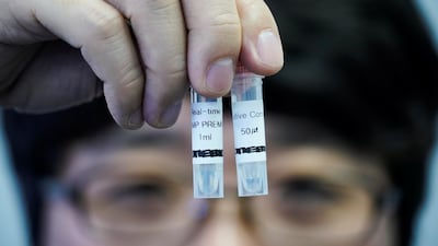 Kim Min-bae, CEO of iONEBIO Inc. poses for photographs with samples of iLAMP Novel-Coronavirus Detection Kit. Reuters