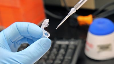 The two Emirati case studies, a man and a woman aged 87, both suffered from high blood pressure. CM Guerrero / TNS via Getty