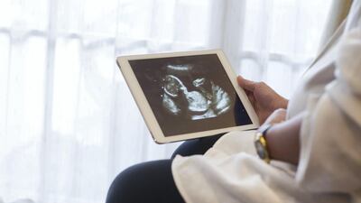 A pregnant woman looks at the ultrasound image of her baby. Getty