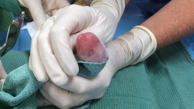 One of Mei Xiang’s twin giant panda cubs is examined by vets at the Smithsonian National Zoo, in Washington. Becky Malinsky / AP Photos