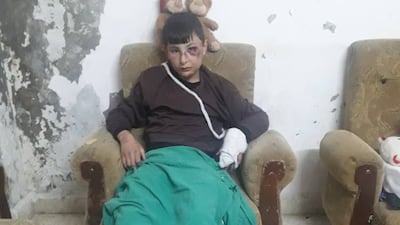 Eman Al Sabbouh's son Ahmad, 12 who survived the earthquake. Credit Eman's sister Rima Al Sabbouh