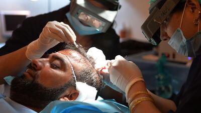 Surgeons perform a hair transplant in a clinic in Islamabad. There are nearly 120 hair transplant clinics in Pakistan, according to official figures, with a dozen in Peshawar. Aamir Qureshi / AFP Photo