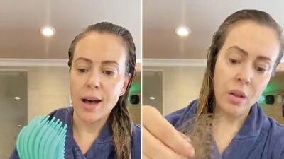 Actress Alyssa Milano has shown the amount of hair she has lost as a result of Covid-19. Instagram / Alyssa Milano