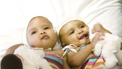 Baby girls Rital and Ritag Gaboura, who are 11 months old, were separated on 15 August after four operations at Great Ormond Street Hospital for Children in London, in an operation funded by the charity Facing the World. Photo Credit: Courtesy Facing the World