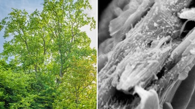 Samples from a tulip tree in Cambridge University's botanic garden, left, revealed a surprising type of wood when put under a microscope, right. Photo: Howard Rice / Jan J Lyczakowski and Raymond Wightman