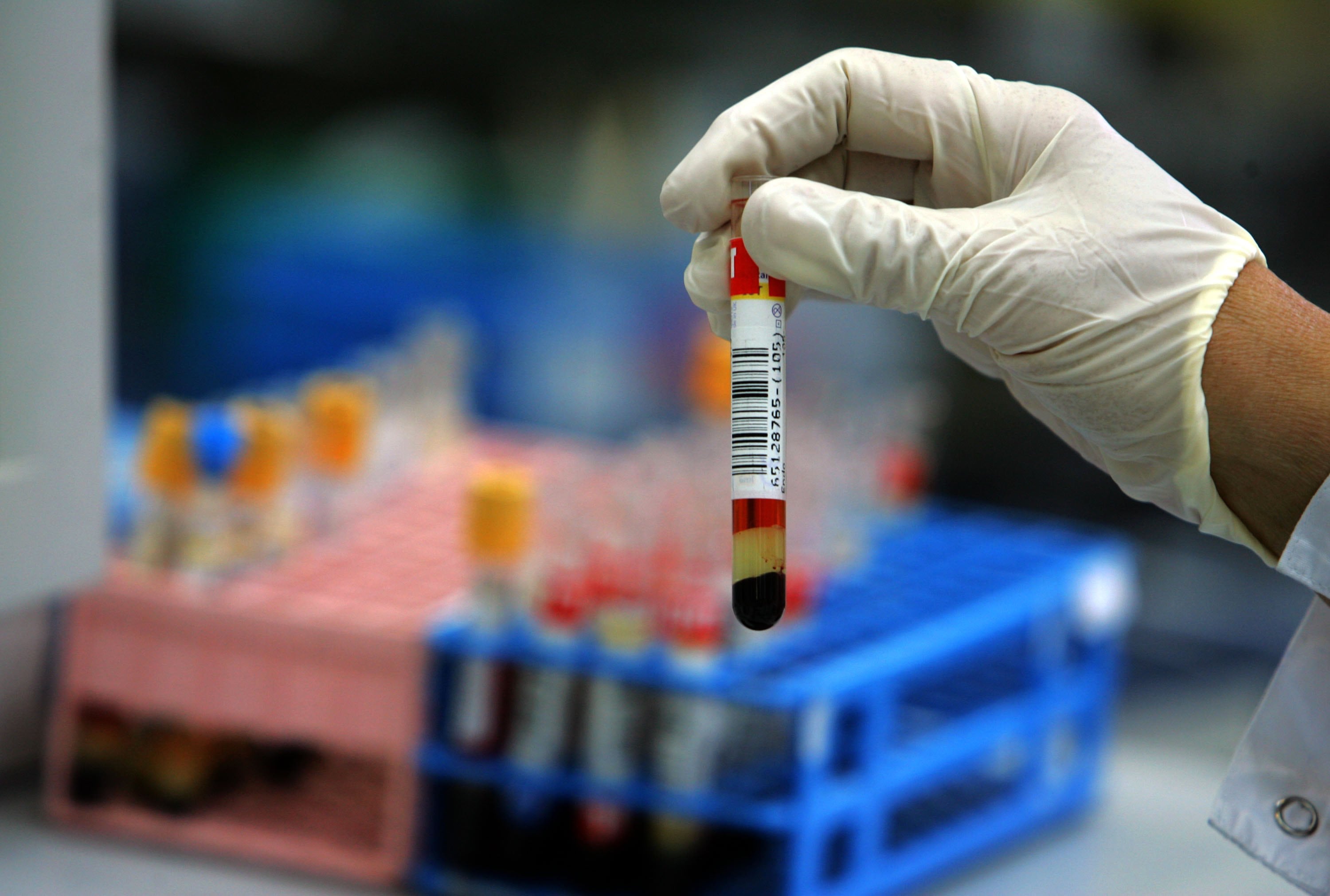 Image linked from the original feed: How simple test for killer cholesterol can prevent fatal heart attack