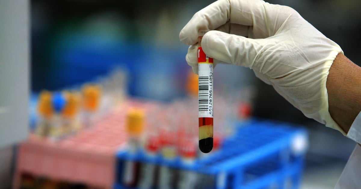 Photo: Thenationalnews LDL cholesterol is behind a third of all heart disease deaths and a quarter of all stroke deaths worldwide. Getty Images
