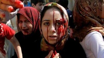 Injured Syrian women arrive at a hospital after an air strike hit their homes in the town of Azzaz yesterday. Young Syrians say they ‘are not able to move a single metre before the security forces and army start shooting at us’.