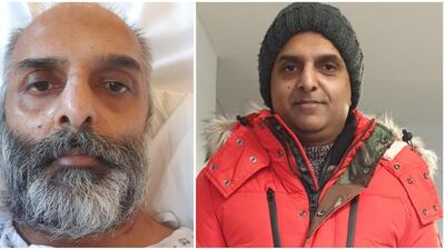 Sohail Anjum was in an induced coma for 25 days. Courtesy Sohail Anjum