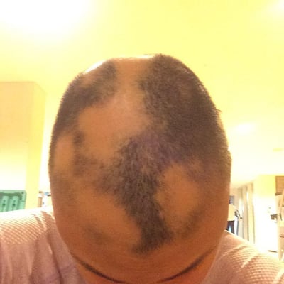 She tells her followers to "wear those patches proud". Yasmin Taylor / Instagram