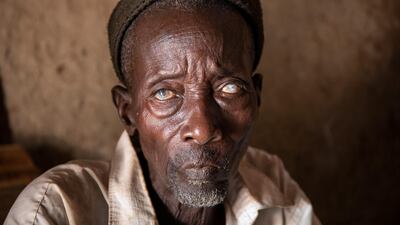 Diba Cisskho, 70, lost his eyesight to river blindness. His translucent eyes are the telltale sign of the disease, which is transmitted by black flies. Courtesy Ed Kashi