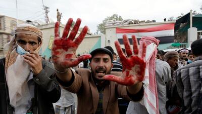 An anti-government protester holds out his blood-stained hands after clashes with security forces, in Sanaa, Yemen, Sunday, Sept. 18, 2011. Yemeni government forces opened fire with anti-aircraft guns and automatic weapons on tens of thousands of anti-go???