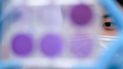 A researcher works on the diagnosis of suspected coronavirus Covid-19 cases in Brazil. AFP / Douglas MAGNO