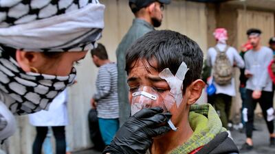 An young injured protester receives first aid during clashes with security forces in Baghdad, Iraq. AP Photo