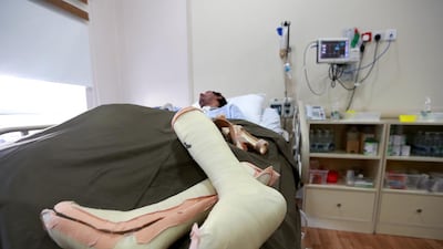 Seriously injured victims of high-speed car crashes often have to have extended care in long-term care facilities. Ravindranath K / The National