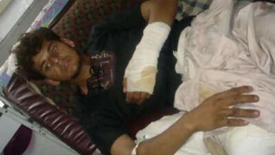 An Afghan boy allegedly wounded by US airstrikes in the Waygal district of Nuristan province lies in a hospital bed.