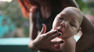 Estafany Perreira holds her nephew David Henrique Ferreira, 5 months, who has microcephaly in Recife, Brazil. In the last four months, authorities have recorded close to 4,000 cases in Brazil in which the mosquito-borne Zika virus may have led to microcephaly in infants. Mario Tama/Getty Images