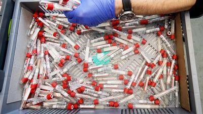 Covid-19 is not yet a thing of the past. AFP