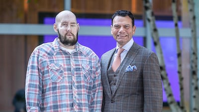 Mr James was injured in accident involving high-voltage power lines, which destroyed most of his face and one eye. Photo: NYU Langone Health