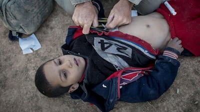 A young boy receives medical treatment for a gunshot wound by a member of the Free Burma Rangers medical unit after arriving at an SDF position on the outskirts of Bagouz. Getty Images