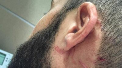 Ahmad Barghouthy says he was assaulted on the flight but was not assisted by cabin crew. Courtesy Ahmad Barghouthy