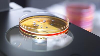 Petri dish containing bacterial culture being examined in a microbiology lab. Roughly 25,000 people die every year in Europe because of infections by drug-resistant bacteria, according to World Health Organisation statistics. Getty Images