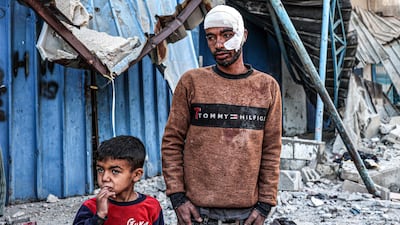 A wounded Palestinian man and a child stand by a destroyed building after Israeli bombardment in Rafah, in the south of the Gaza Strip. AFP